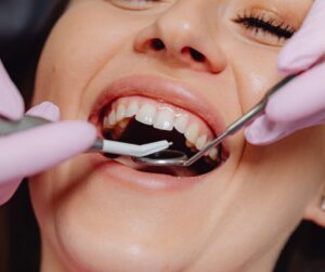Tooth Extraction
