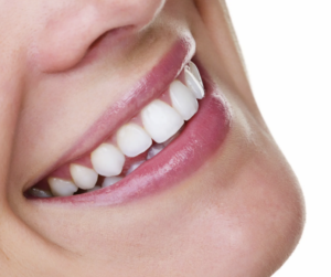 Wisdom Teeth Extraction