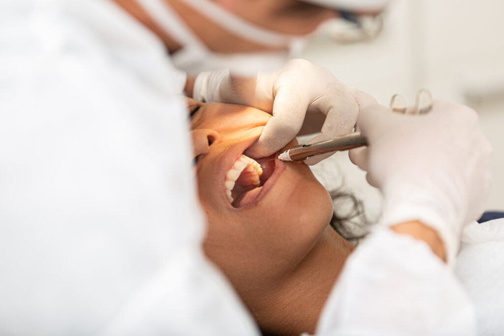 wisdom teeth extraction