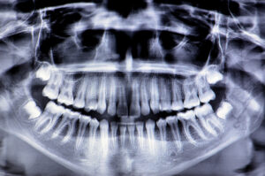 jaw fracture treatment, orbital fracture treatment, avulsed tooth treatment, facial injury surgery, oral surgeon for facial trauma